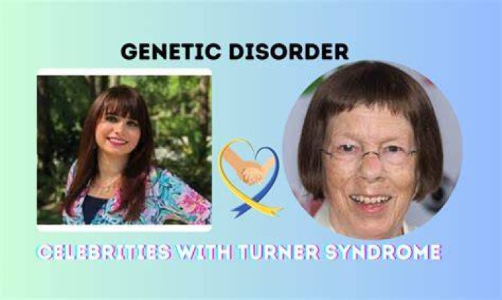 10 Famous People With Turner Syndrome: Inspiring Stories Of Resilience
