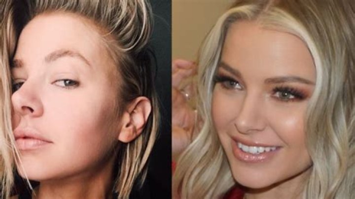 Ariana Madix Nose Job: Before and After Plastic Surgery