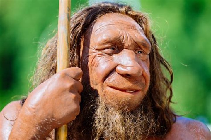 Does Ron Perlman Have Perlman Syndrome? Face Disease: Why Does He Look Like A Neanderthal?