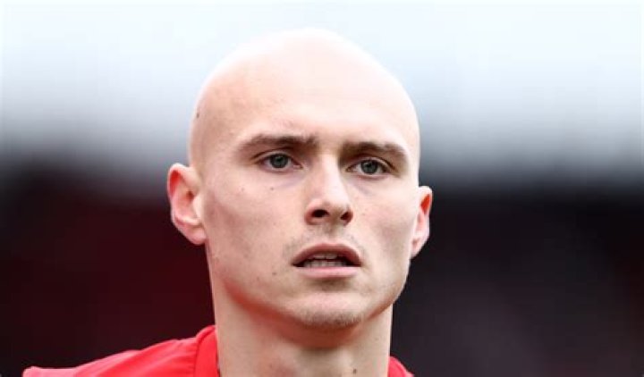 Footballer: What Happened To Will Smallbone Hair? Illness Alopecia -Details To Know