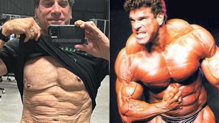 Is Lou Ferrigno Deaf? Unraveling The Health Battles Of An Iconic Bodybuilder