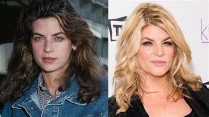 Kirstie Alley’s Plastic Surgery: Did The Cheers Star Have Botox and a Facelift?