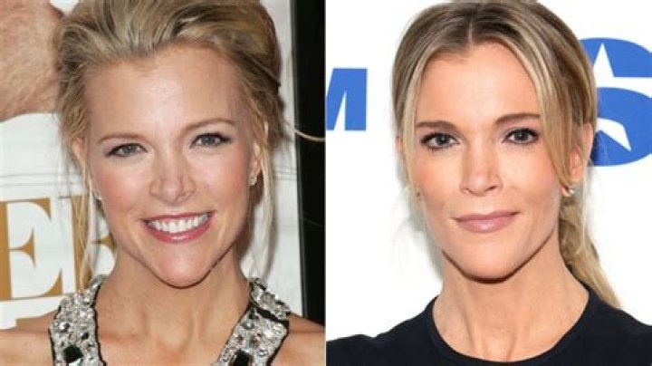 What Happened to Megyn Kelly on Fox: A Comprehensive Analysis