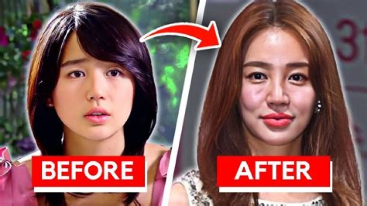 Youtuber: Song Jia Before & Plastic Surgery – Her Transformation Exposed